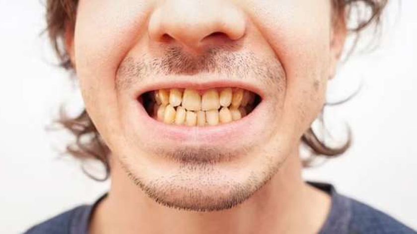 7 نصائح لتقوية مينا الأسنان.. وطبيب يحذر من غسلها في هذا التوقيت