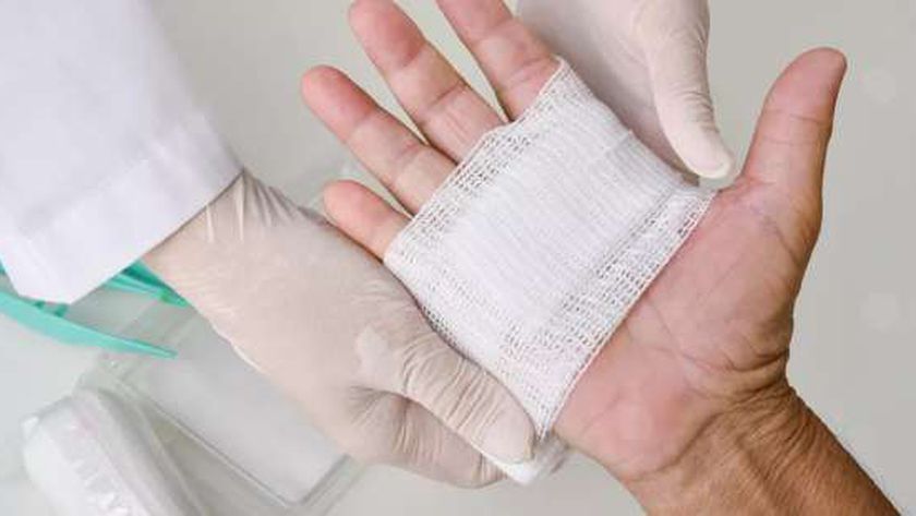 خطوات بسيطة تخفف من إصابات الحروق.. «احذر استخدام البن أو معجون الأسنان»