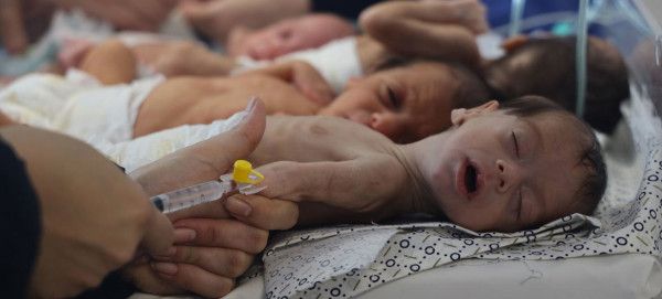 غزة: ارتفاع عدد الشهداء الأطفال جراء سوء التغذية إلى 66 طفلاً