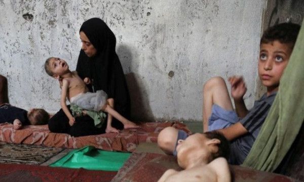 خمس وفيات نتيجة التجويع في قطاع غزة خلال الـ24 ساعة الماضية