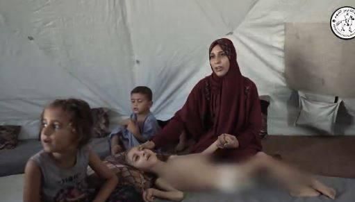 «الفارس الشهم 3» تنقذ طفلاً من سوء التغذية في غزة