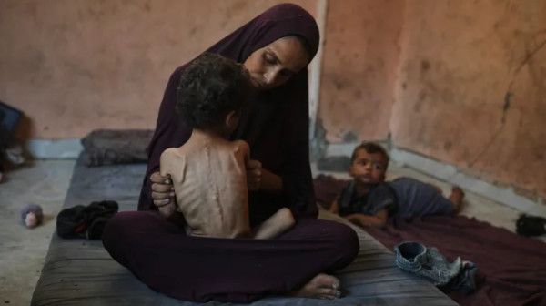 غزة: 453 شهيداً بينهم 150 طفلاً نتيجة المجاعة وسوء التغذية