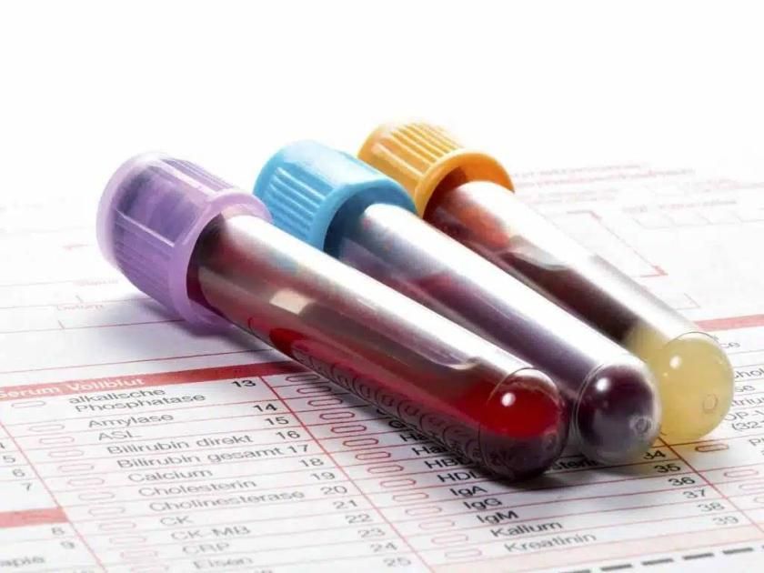 بعد سن الأربعين.. لا تتجاهل هذه التحاليل الستة قد تنقذك من أزمات مفاجئة
