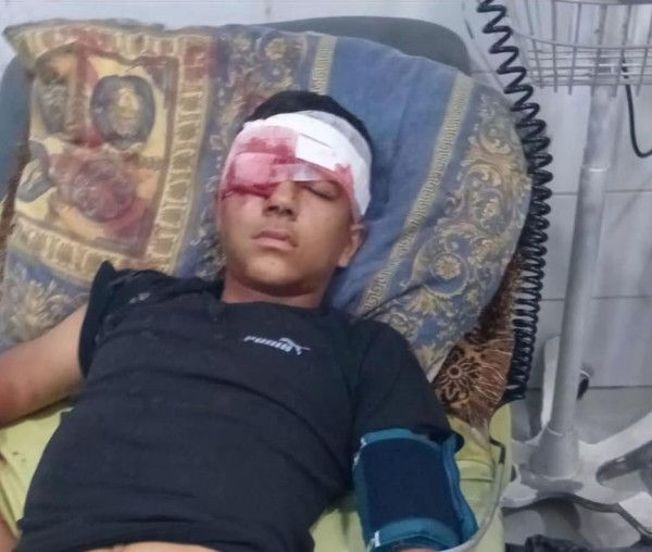 إصابة طفل بجروح خطيرة خلال اقتحام الاحتلال بيت عوا جنوب غرب الخليل