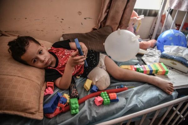 غزة تسجّل أعلى معدل لبتر الأطراف لدى الأطفال نسبةً لعدد السكان عالمياً
