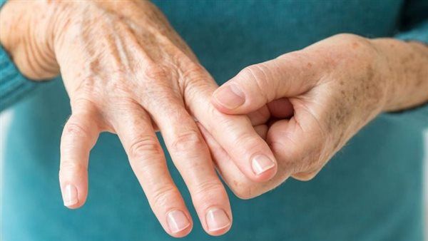 أعراض الروماتويد وأسباب الإصابة به وطرق العلاج