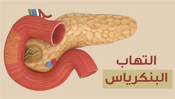 أعراض التهاب البنكرياس، استشاري باطنة يوضح ويحذر من إهمالها