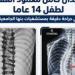 التعليم العالي: استعدال كامل للعمود الفقري لطفل 14 عامًا بمستشفيات جامعة بنها