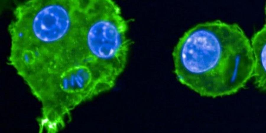 تحذريرات من بكتيريا مقاومة للمضادات تنتشر بسرعة وتهدد حياة الملايين