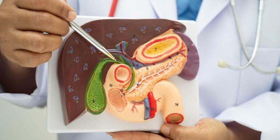 نصائح هامة لـ"مرضى المرارة" في رمضان.. اختيار الطعام "سر الراحة"