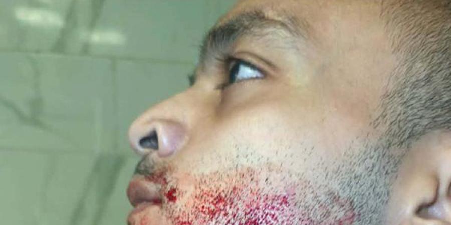 شاب يستغيث من خاله: باع ورثنا واعتدى علينا بسلاح أبيض بالعمرانية